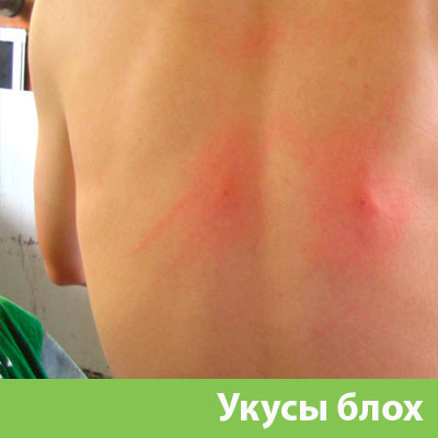 Укусы блох в Давлеканово
